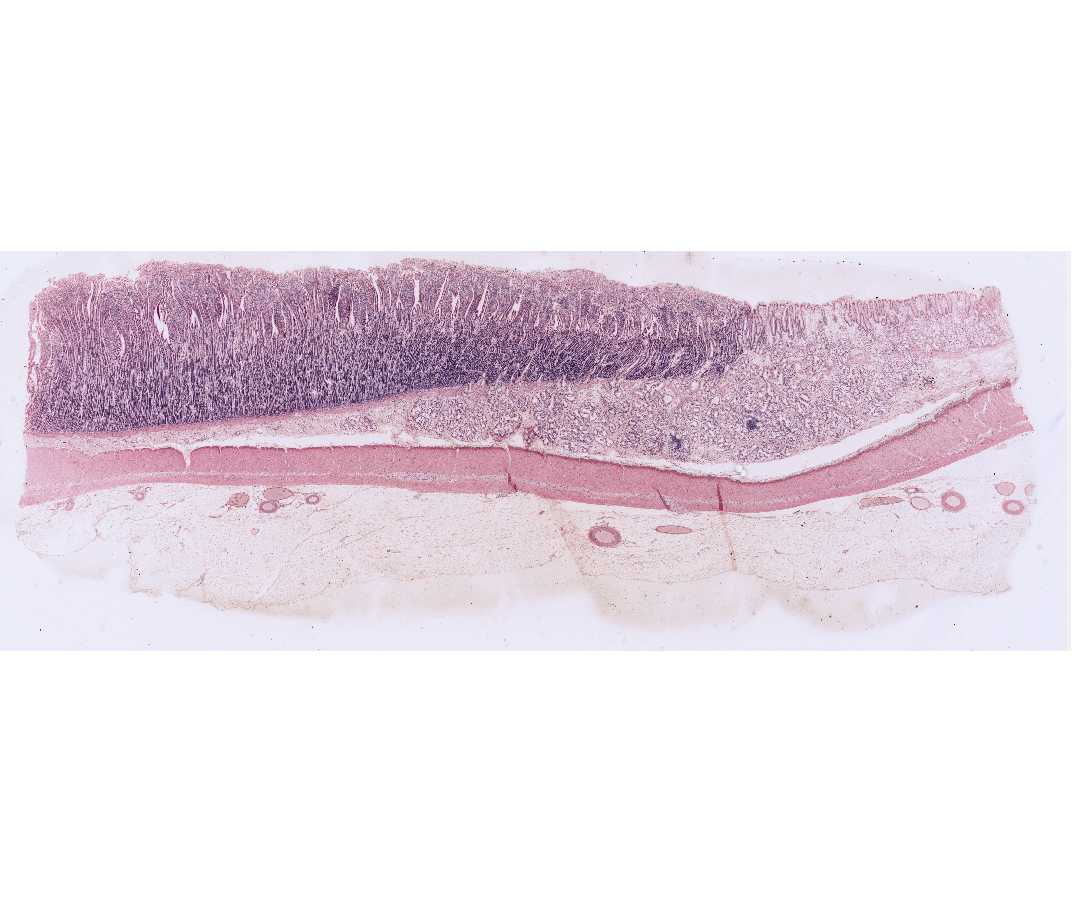 small intestine slide