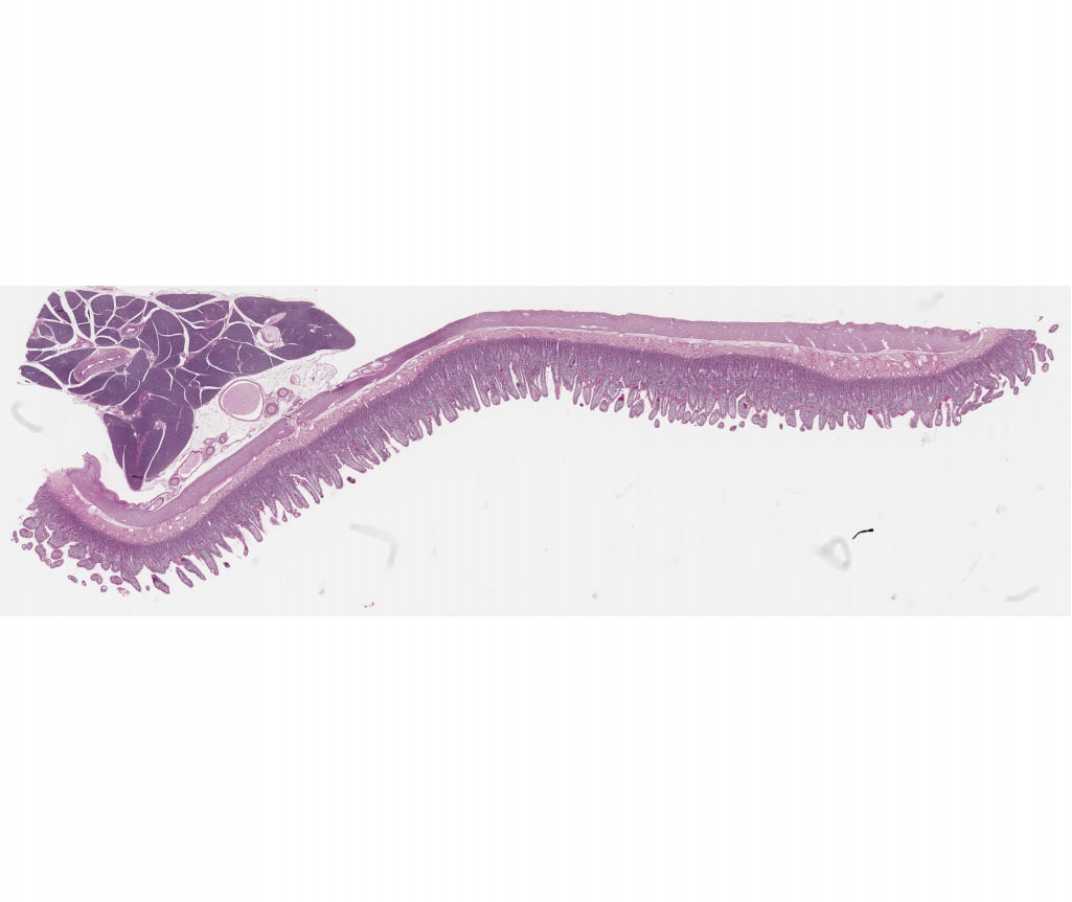small intestine slide