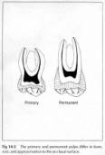 PowerPoint Presentation - Anatomy of Primary Teeth